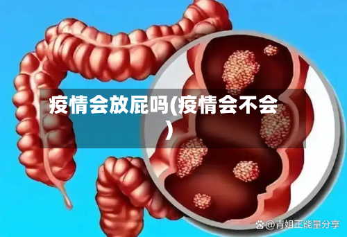 疫情会放屁吗(疫情会不会)