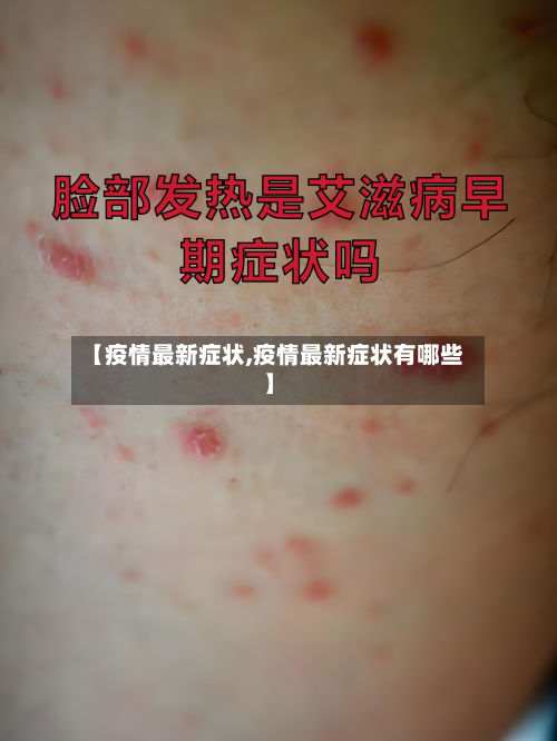 【疫情最新症状,疫情最新症状有哪些】-第1张图片
