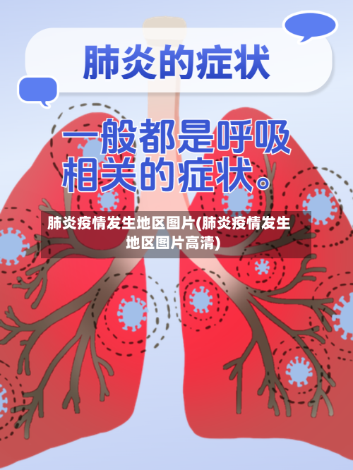 肺炎疫情发生地区图片(肺炎疫情发生地区图片高清)-第2张图片